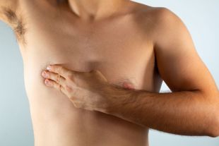 Los síntomas en hombres son similares a los observados en mujeres e incluyen la presencia de un bulto o engrosamiento en el tejido mamario, cambios en la piel que cubre la mama, como hoyuelos, arrugas o enrojecimiento, y en ocasiones, hundimiento o secreción en el pezón.