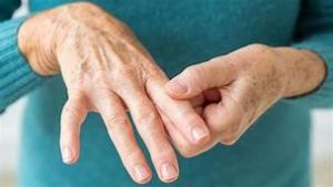 Artritis reumatoide, una enfermedad común en mujeres de 50 a 60 años de edad